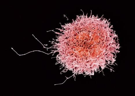J Immunol：揭秘NK细胞的产生成熟机制 有望开发出治疗